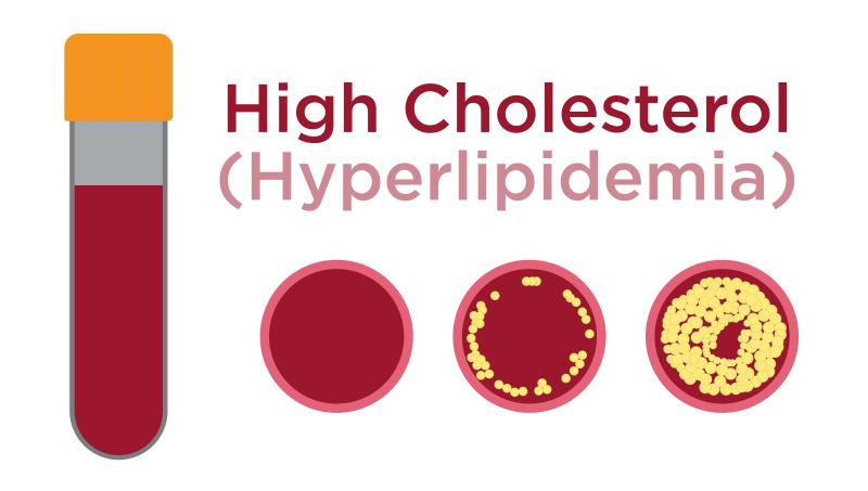 HYPERLIPIDEMIA